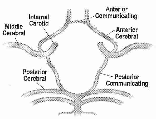 Circle of Willis