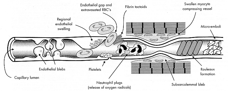 "NO REFLOW" MECHANISMS