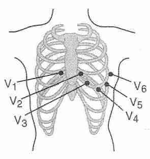 [precordial electrodes ]