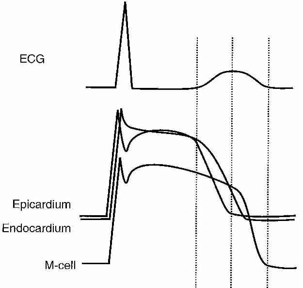 Ventricular repolarization